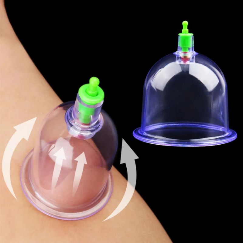 Vakuumkoppningsset – Komplett set med 6 koppar för cirkulation, återhämtning och hudhälsa