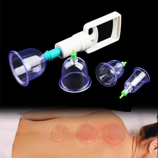 Vakuumkoppningsset – Komplett set med 6 koppar för cirkulation, återhämtning och hudhälsa